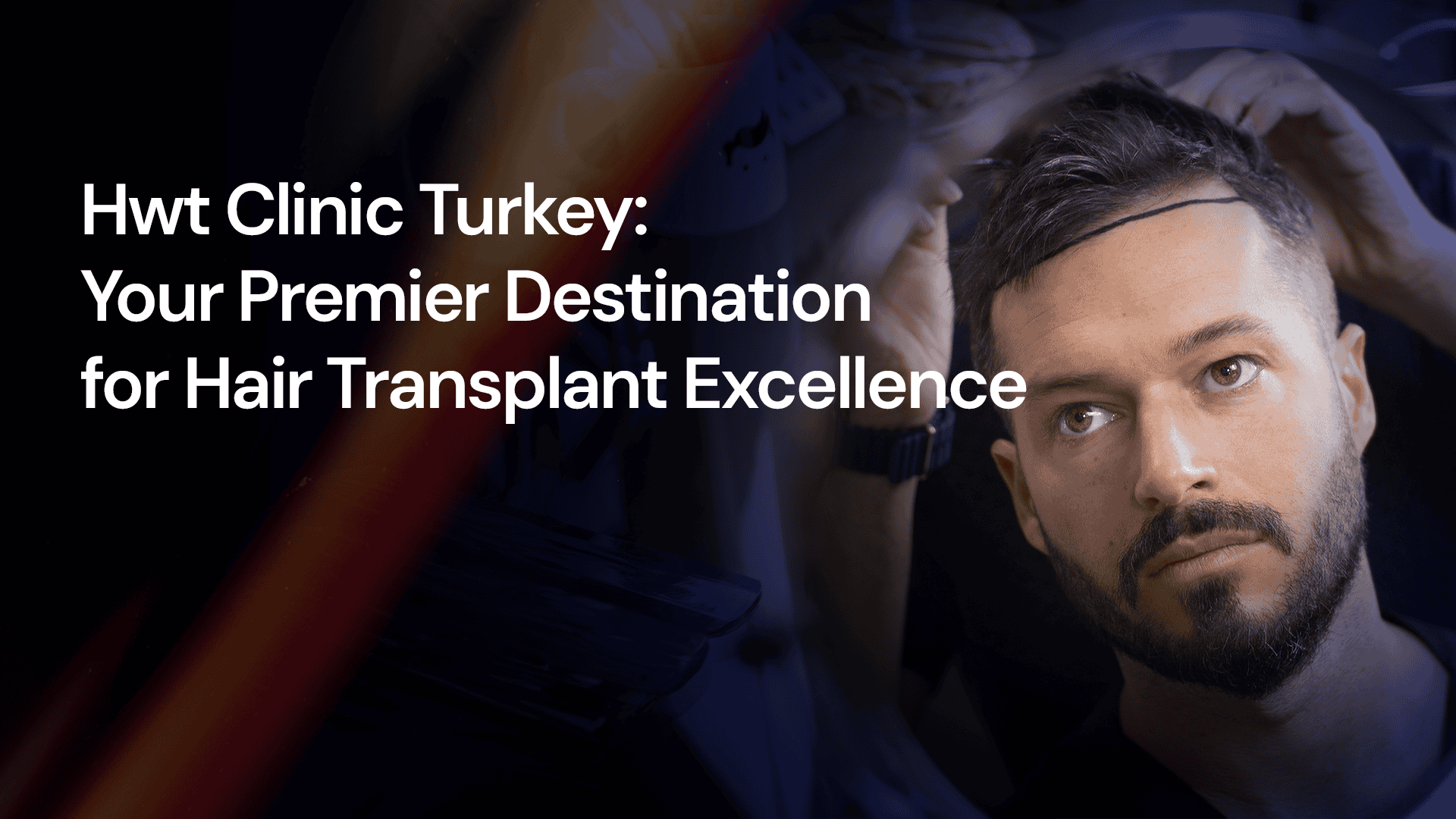 Read Hwtclinic Turkey: Your Premier Destination for Hair Transplant Excellence